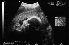 Sonographer Appreciation